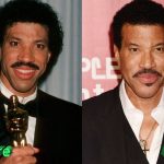 Lionel Richie Before and After Plastic Surgery 150x150