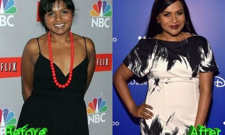 Mindy Kaling Plastic Surgery: Is it a Project Well Done?