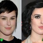 Rumer Willis Before and After Cosmetic Surgery 150x150