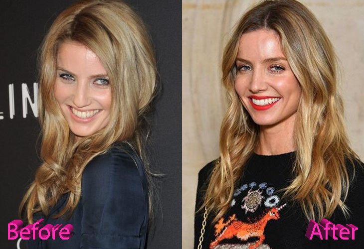Annabelle Wallis Before and After Nose Job