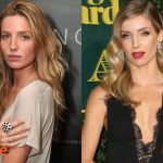 Annabelle Wallis Before and After Rhinoplasty 150x150