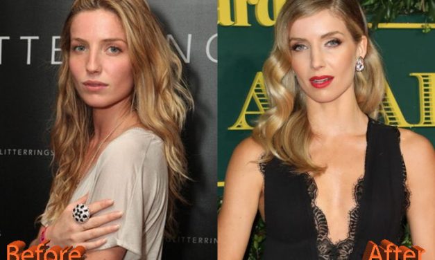 Annabelle Wallis Plastic Surgery: Did Peaky Blinders Fans Spot a Nose Job? 👀