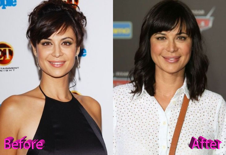 Catherine Bell Before and After Cosmetic Surgery