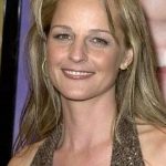 Helen Hunt Before Plastic Surgery 150x150