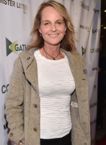 Helen Hunt Plastic Surgery Gossips