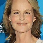 Helen Hunt Plastic Surgery Rumors 150x150