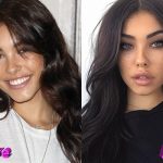 Madison Beer Before and After Cosmetic Surgery 150x150