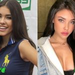 Madison Beer Before and After Plastic Surgery 150x150