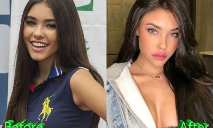Madison Beer Plastic Surgery: Work Of Mother Nature?