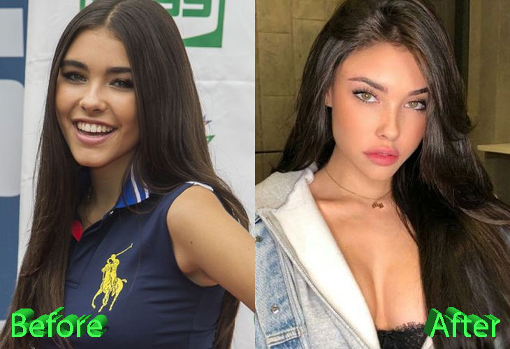 Madison Beer Plastic Surgery: Work Of Mother Nature?