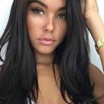 Madison Beer Plastic Surgery Gossips 150x150
