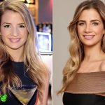 Naomie Olindo Before and After Nose Job Surgery 150x150