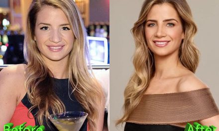 Naomie Olindo Nose Job: A Good Change In Appearance