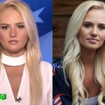 Tomi Lahren Before and After Cosmetic Surgery 150x150