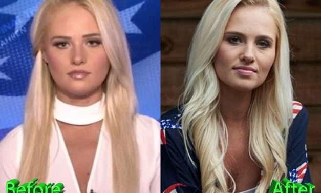 Tomi Lahren’s Plastic Surgery: What’s the Real Story?