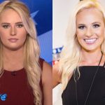 Tomi Lahren Before and After Plastic Surgery 150x150