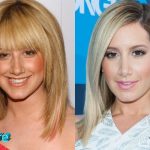 Ashley Tisdale Before and After Nose Job 150x150