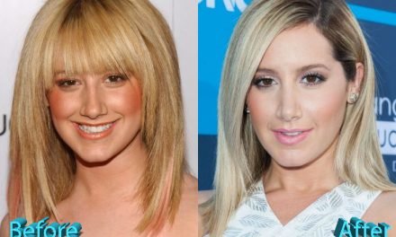Ashley Tisdale Nose Job: The Fans Are Quite Confused