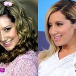 Ashley Tisdale Before and After Nose Job Surgery 150x150