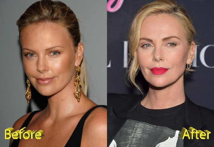 Charlize Theron Before and After Cosmetic Surgery