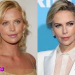 Charlize Theron Before and After Plastic Surgery 150x150