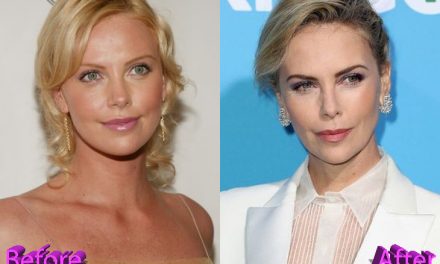 Charlize Theron Plastic Surgery Rumors Sparked By Tully and Gringo