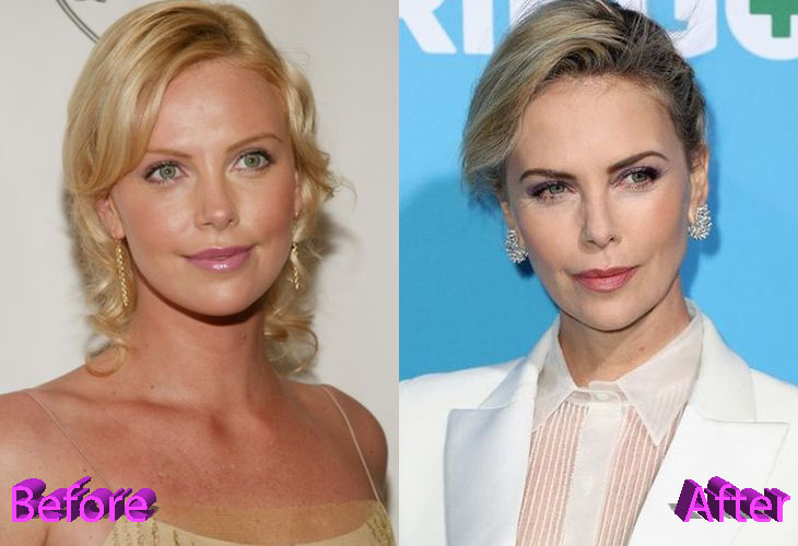 Charlize Theron Plastic Surgery Rumors Sparked By Tully and Gringo