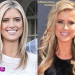 Christina El Moussa Before and After Cosmetic Surgery 150x150