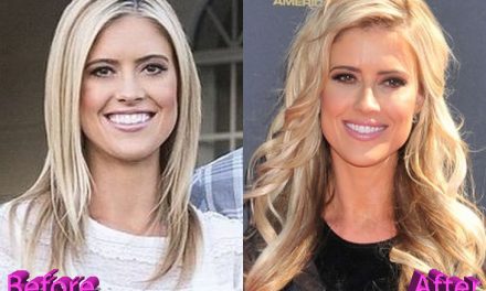 Christina El Moussa Plastic Surgery: More Than Just A Boob Job?