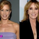Felicity Huffman Before and After Cosmetic Surgery 150x150