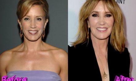Felicity Huffman Plastic Surgery: Was It A Good Idea Though?