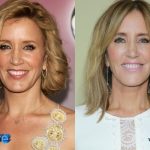 Felicity Huffman Before and After Plastic Surgery