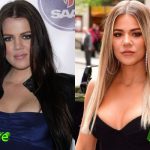 Khloe Kardashian Before and After Plastic Surgery 150x150