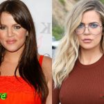 Khloe Kardashian before and After Cosmetic Surgery 150x150
