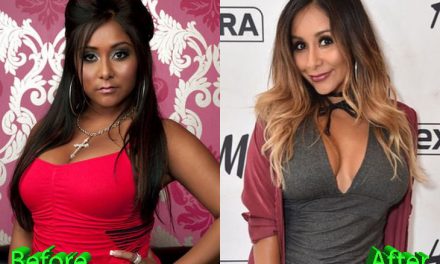 Snooki Plastic Surgery: A long Way From Jersey Shore