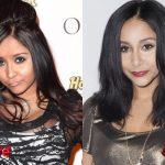 Snooki Before and After Plastic Surgery 150x150