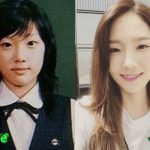 Taeyeon Before and After Cosmetic Surgery 150x150