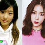 Taeyeon Before and After Plastic Surgery