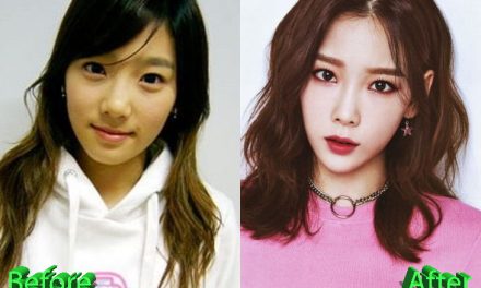 Taeyeon Plastic Surgery Rumors Sparked Off by Recent Snapshots