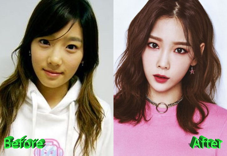 Taeyeon Plastic Surgery Rumors Sparked Off by Recent Snapshots