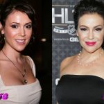 Alyssa Milano Before and After Cosmetic Surgery 150x150