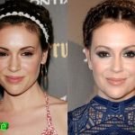 Alyssa Milano Before and After Plastic Surgery