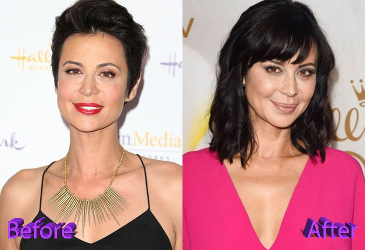 Catherine Bell Before and After Cosmetic Surgery