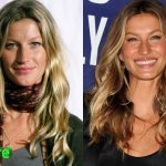 Gisele Bundchen Before and After Cosmetic Surgery 150x150
