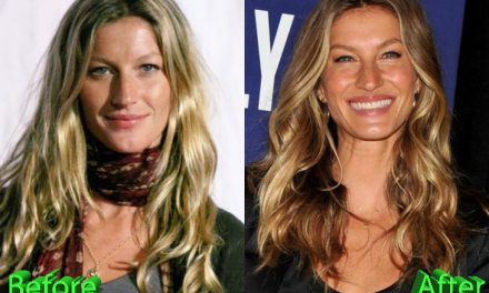 Gisele Bundchen Plastic Surgery And The Paris Burqe Affair