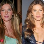 Gisele Bundchen Before and After Plastic Surgery