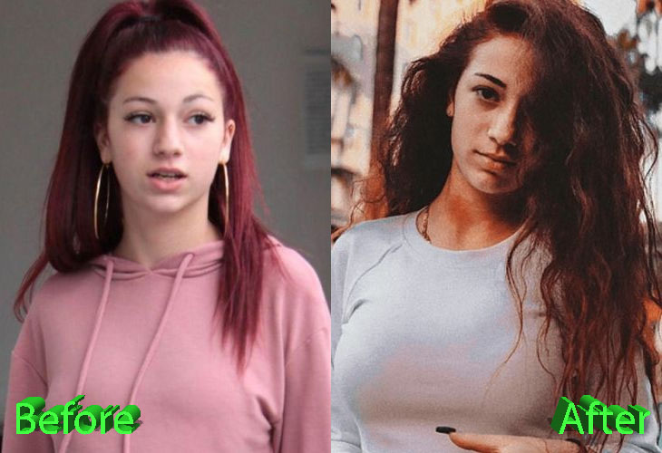 Danielle Bregoli Before and After Boob Job