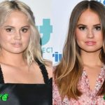 Debby Ryan Before and After Cosmetic Surgery 150x150