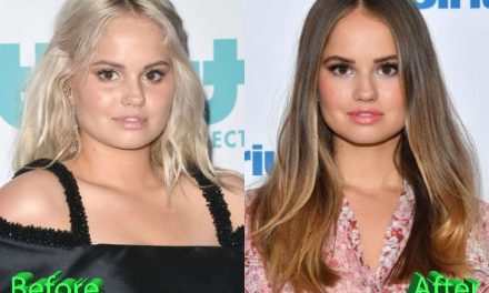 Debby Ryan Plastic Surgery: Did You Really Need It Debby?