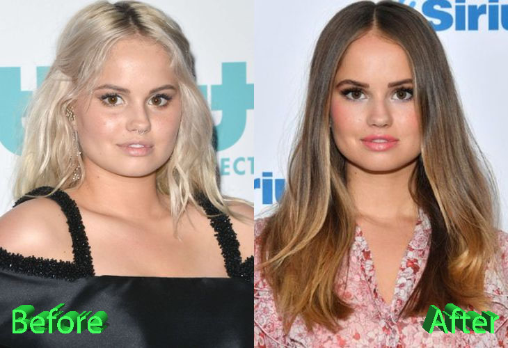 Debby Ryan Before and After Cosmetic Surgery